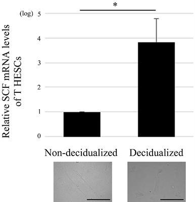 Decidualization of Stromal Cells Promotes Involvement of Mast Cells in Successful Human Pregnancy by Increasing Stem Cell Factor Expression